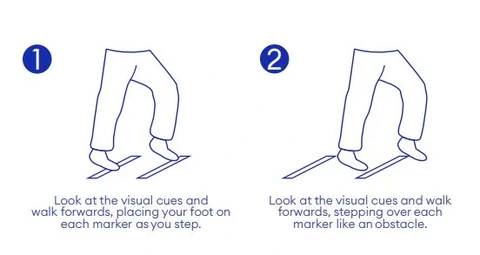 Visual cues in Perkinsons’ disease Visual cues in Perkinsons’ disease