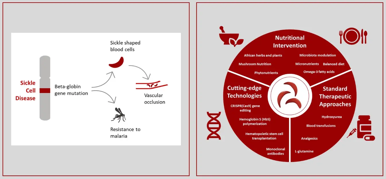 Figure 1: Sickle Cell Disease treatment and challenges