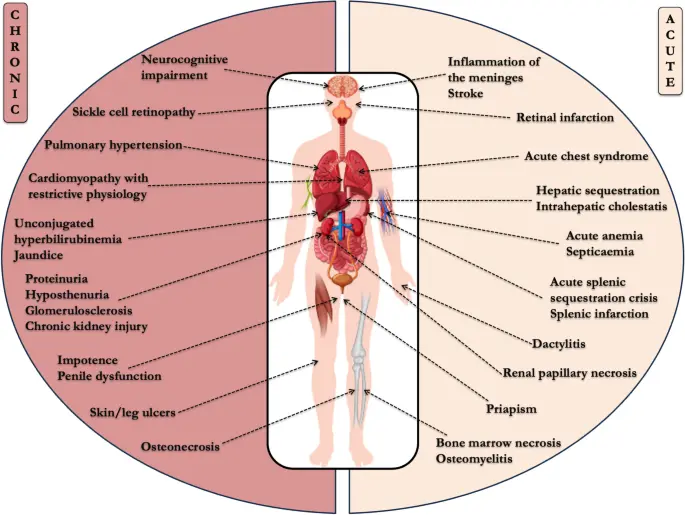 Figure 4: Diagnosis and management of Sickle cell disease