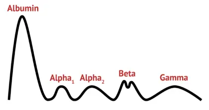 Figure 4: Multiple myeloma