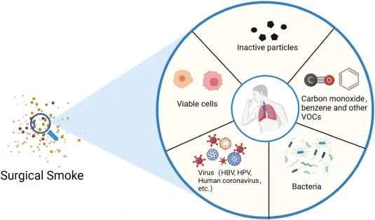 Impact of Surgical Smoke in Operation Theatre