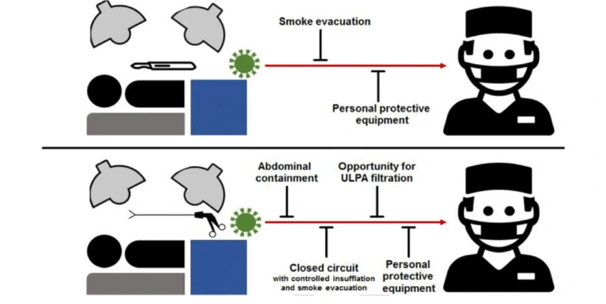 Safety from Surgical Smoke